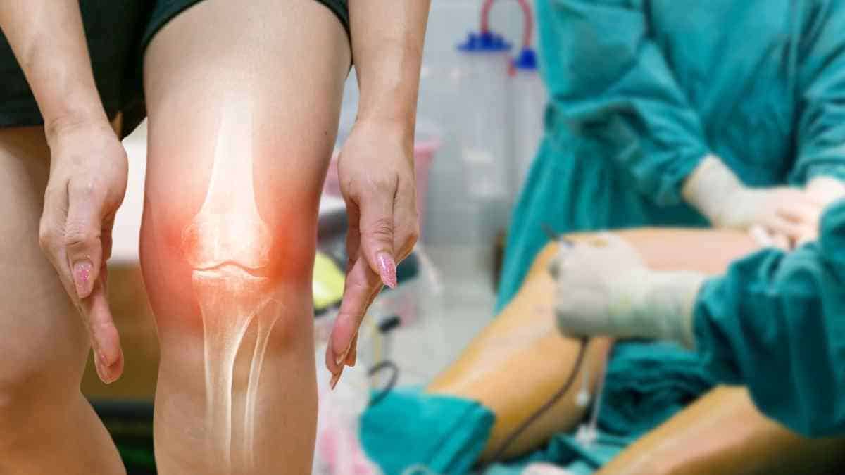 Artrose no joelho aposenta
